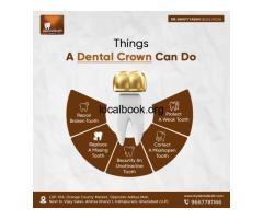 Best Dental Clinic for Tooth Cap in Indirapuram