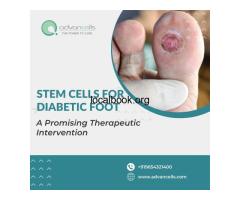 Stem Cells For Diabetic Foot: A Promising Therapeutic Intervention