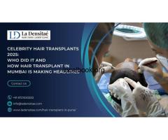 Celebrity Hair Transplants 2025