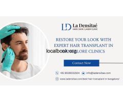 Restore Your Look with Expert Hair Transplant in Bangalore Clinics