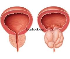 Top Urology Hospital
